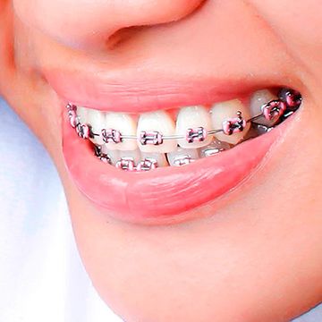 Biodent Clínica Dental Ortodoncia